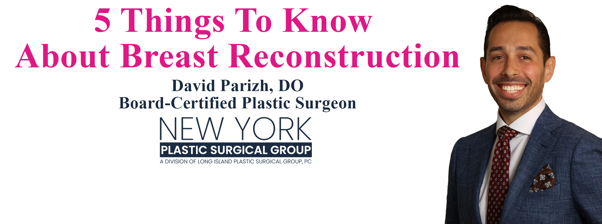 5thingstoknow_reconstruction